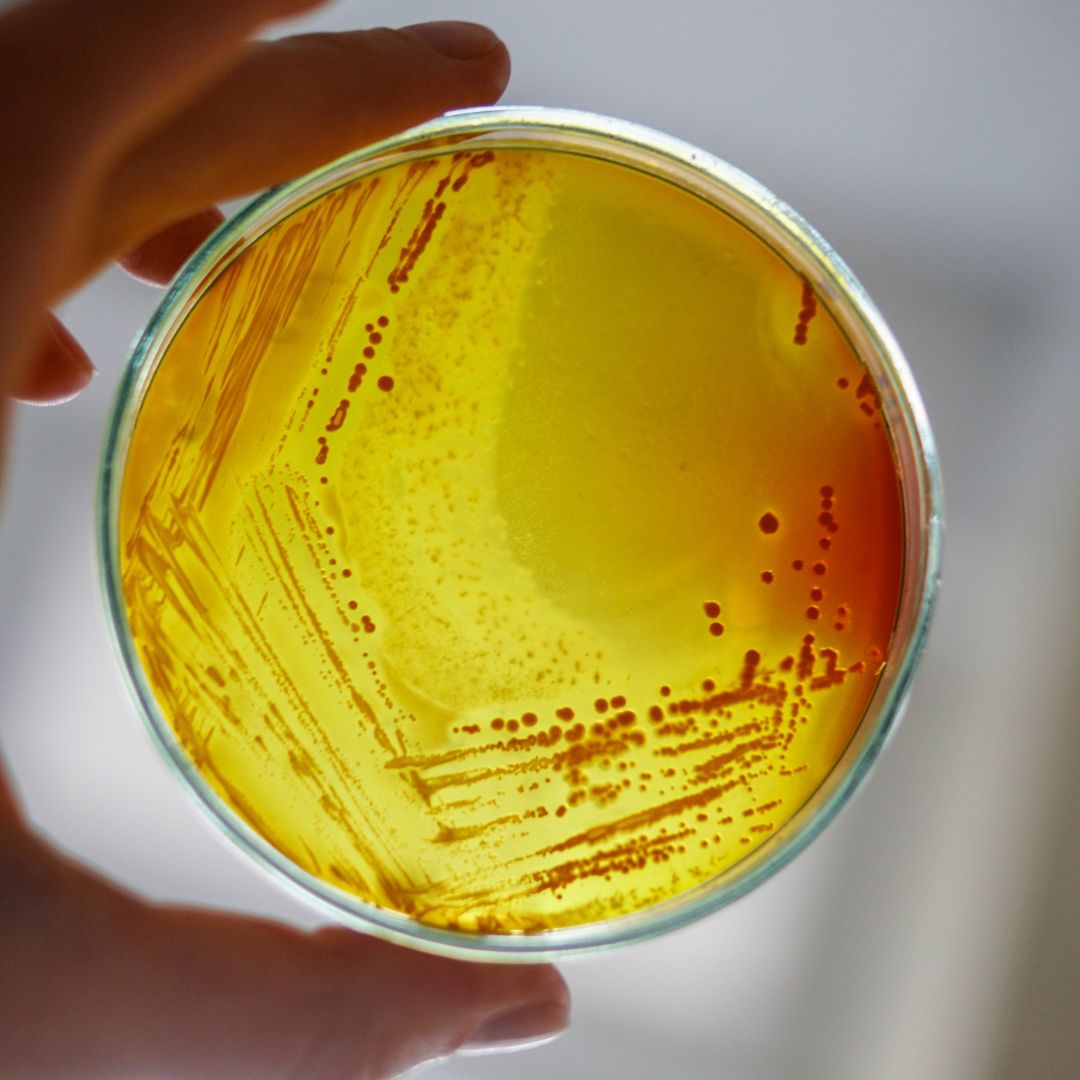Biorremediación por bacterias